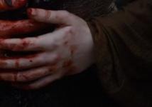 stab wound